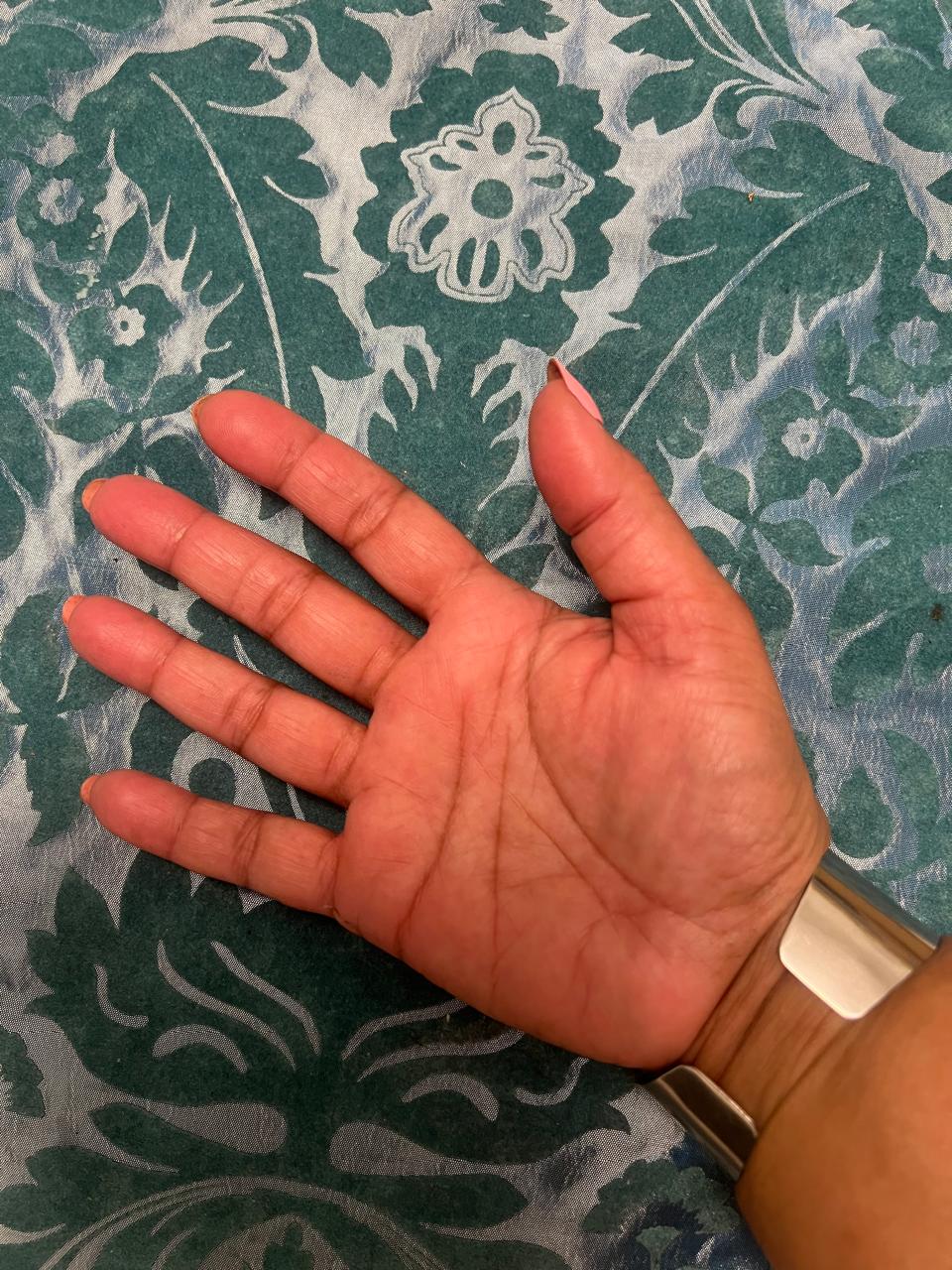 Right Hand Front