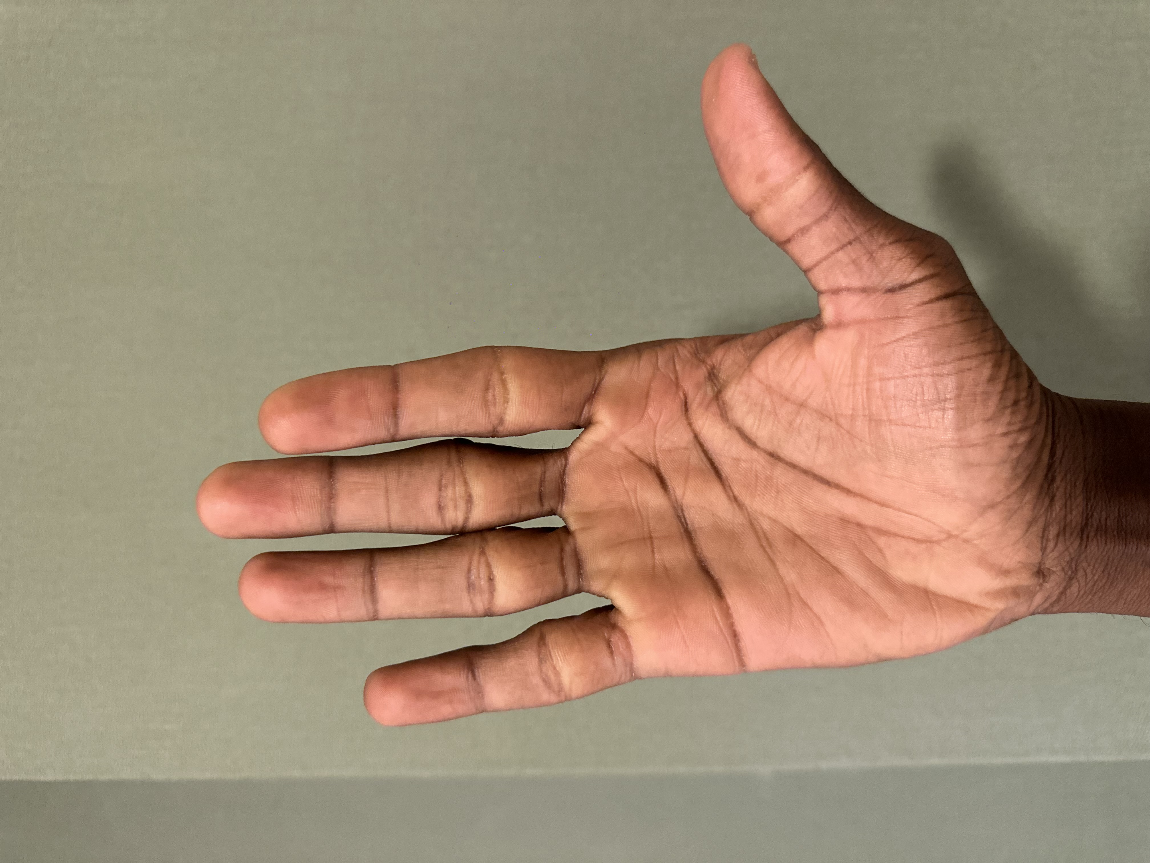 Right Hand Front