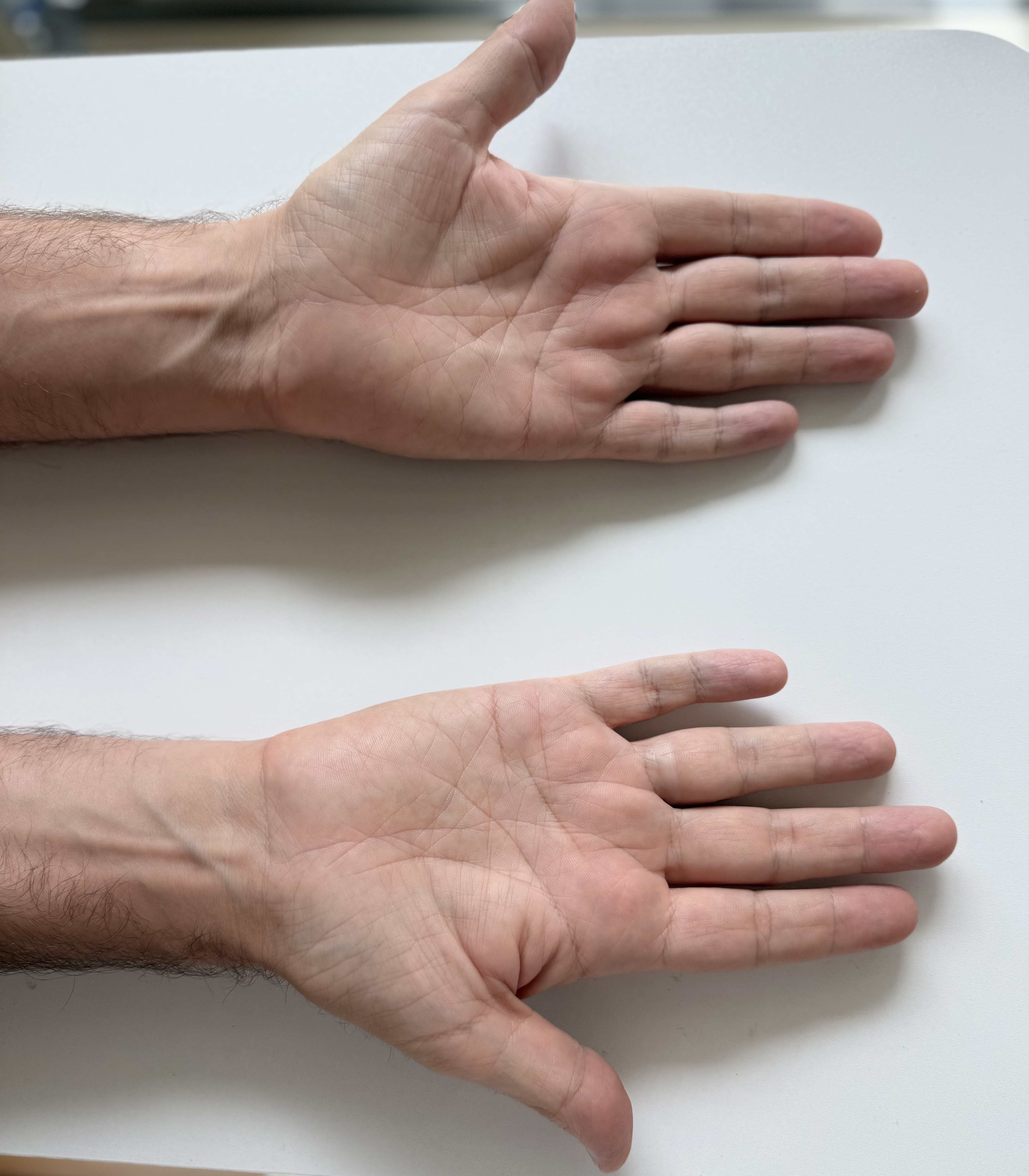 Left Hand Back