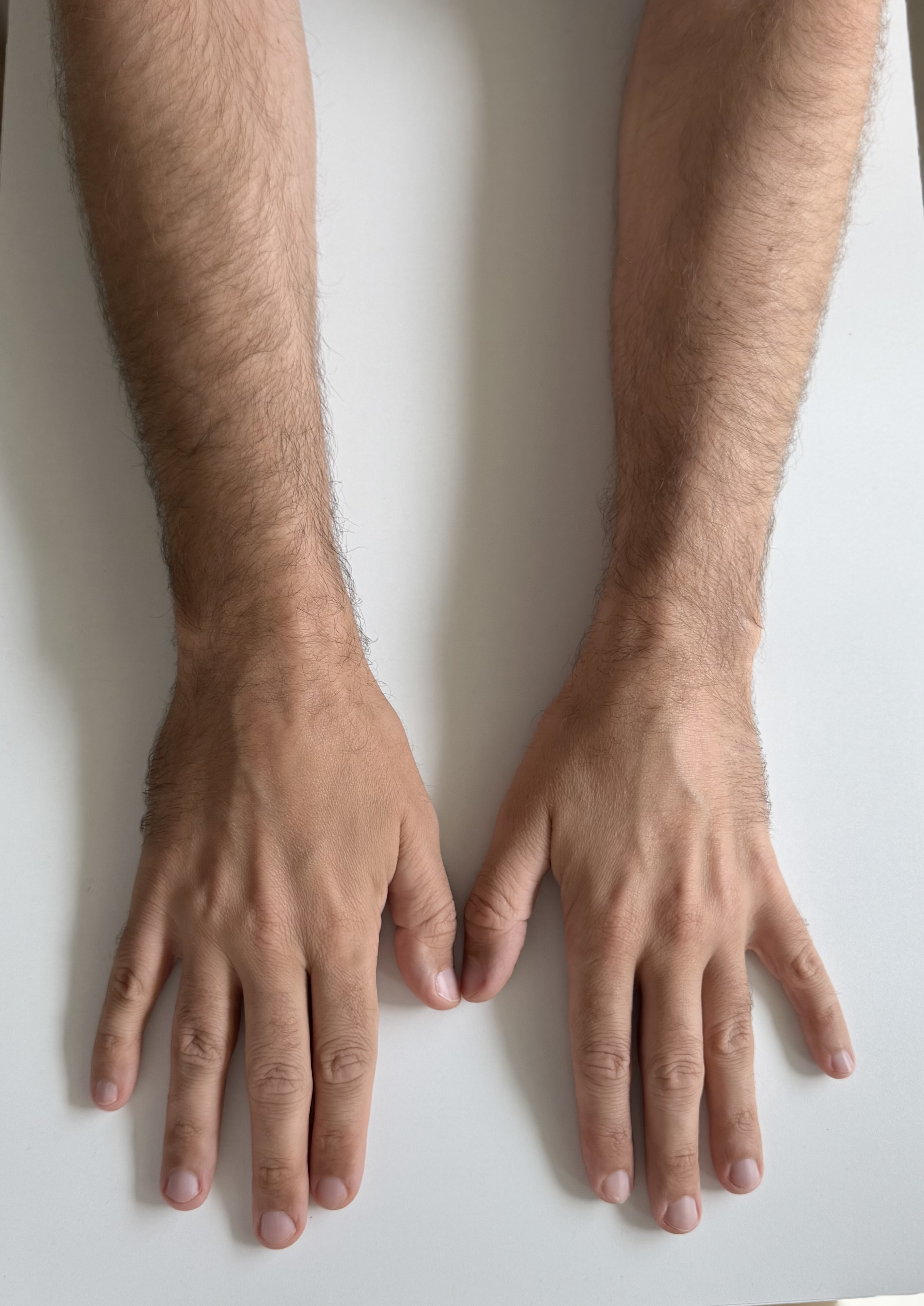 Right Hand Back