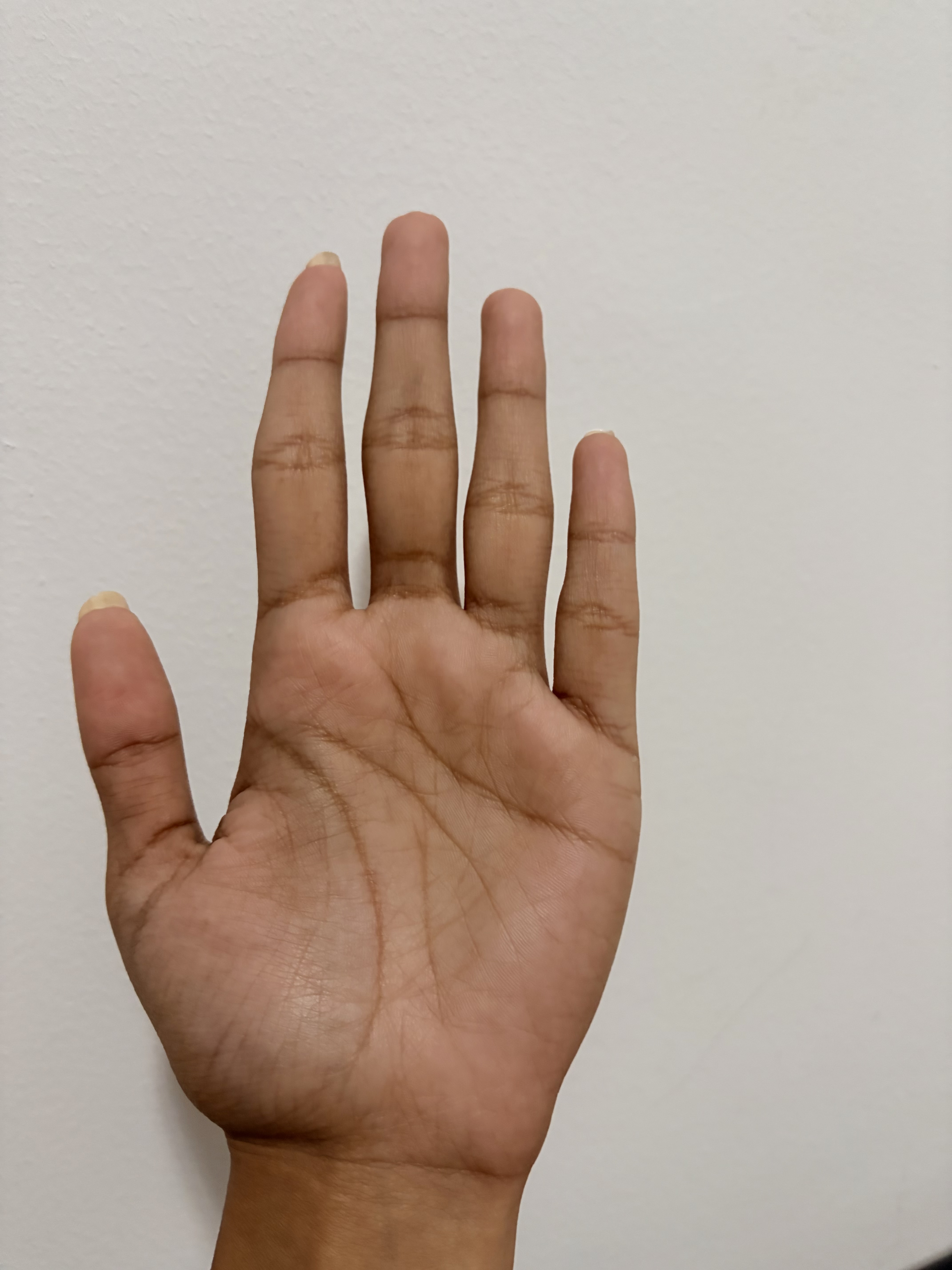 Left Hand Back
