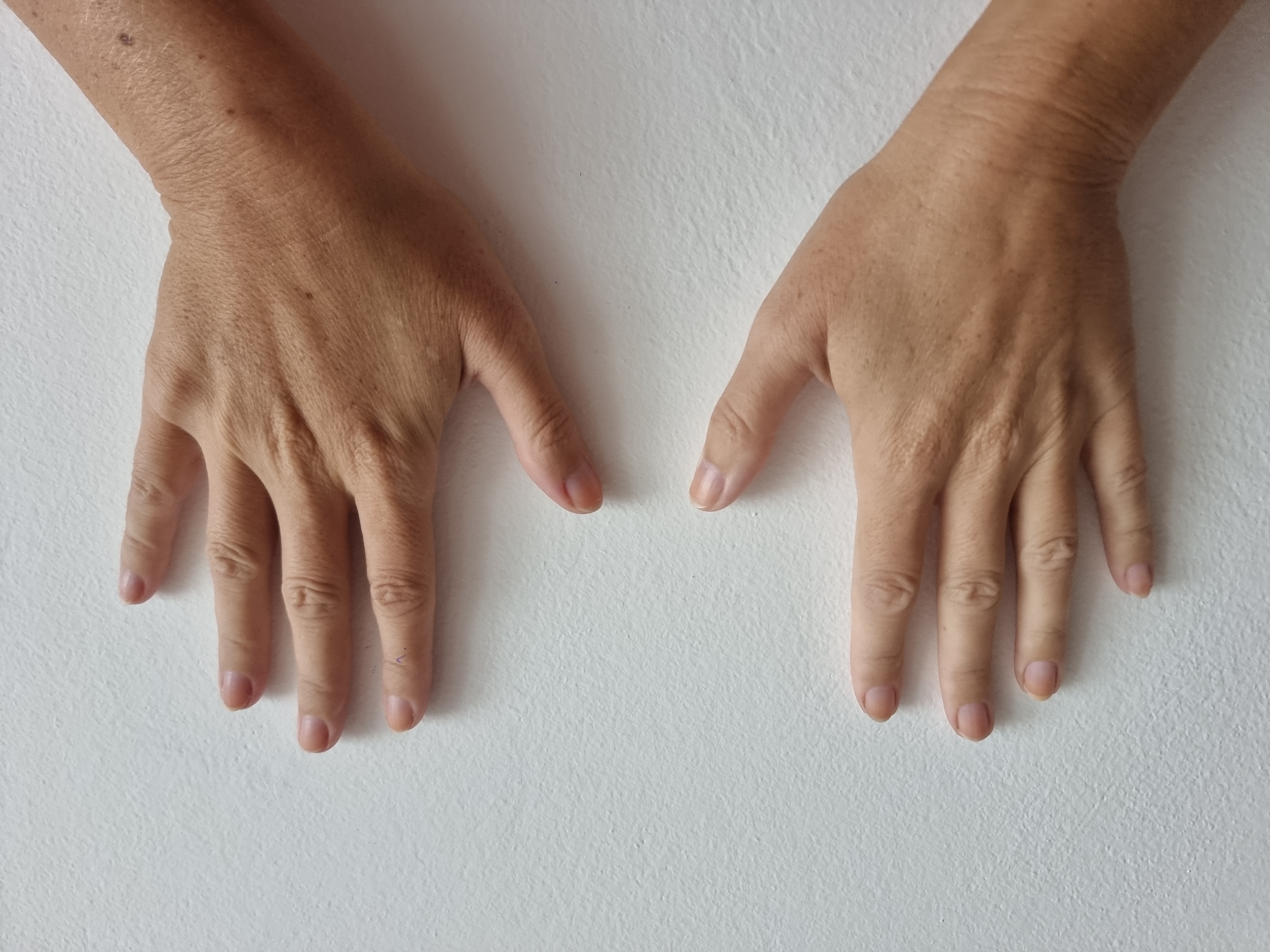 Left Hand Front