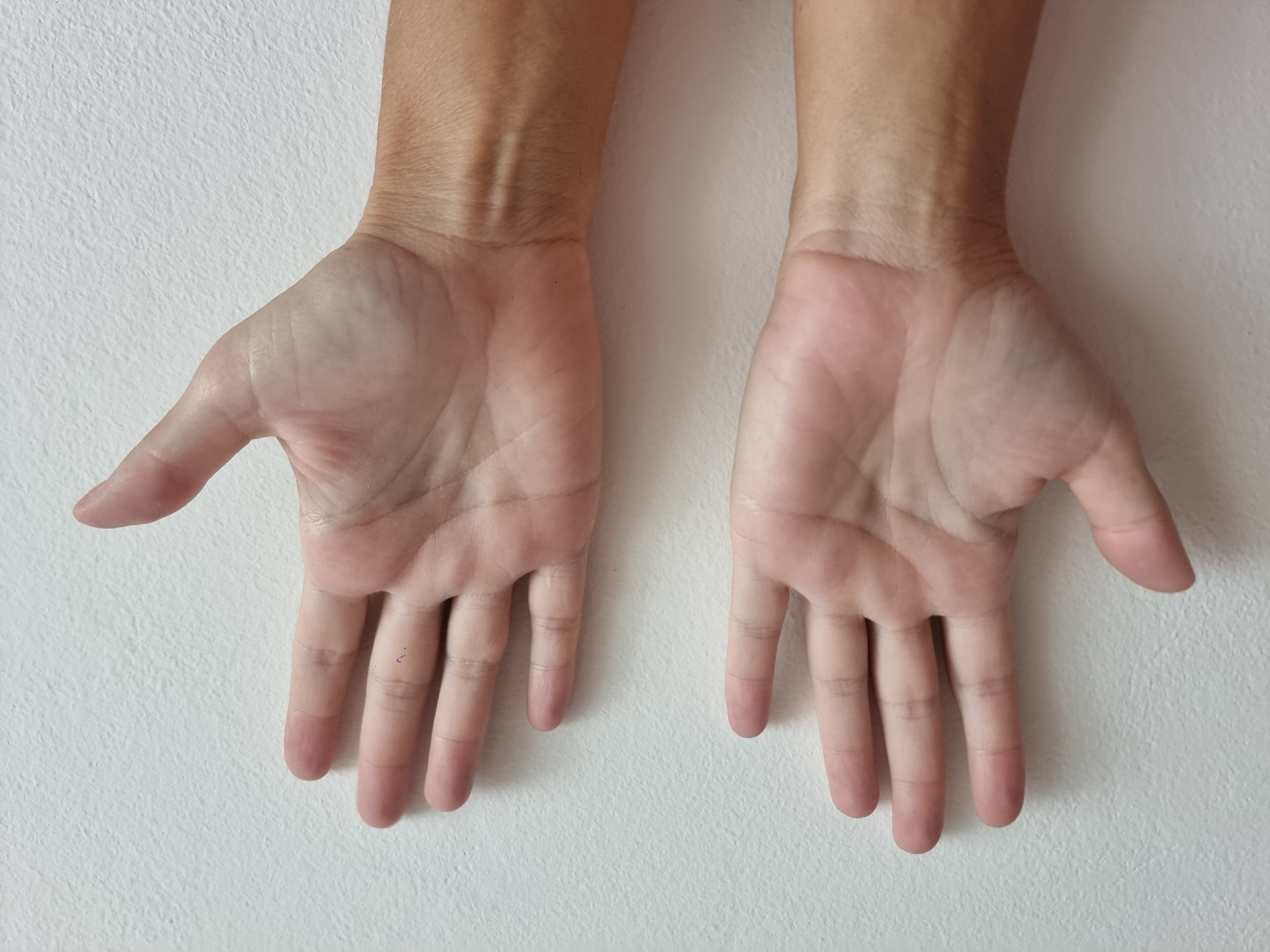 Right Hand Back