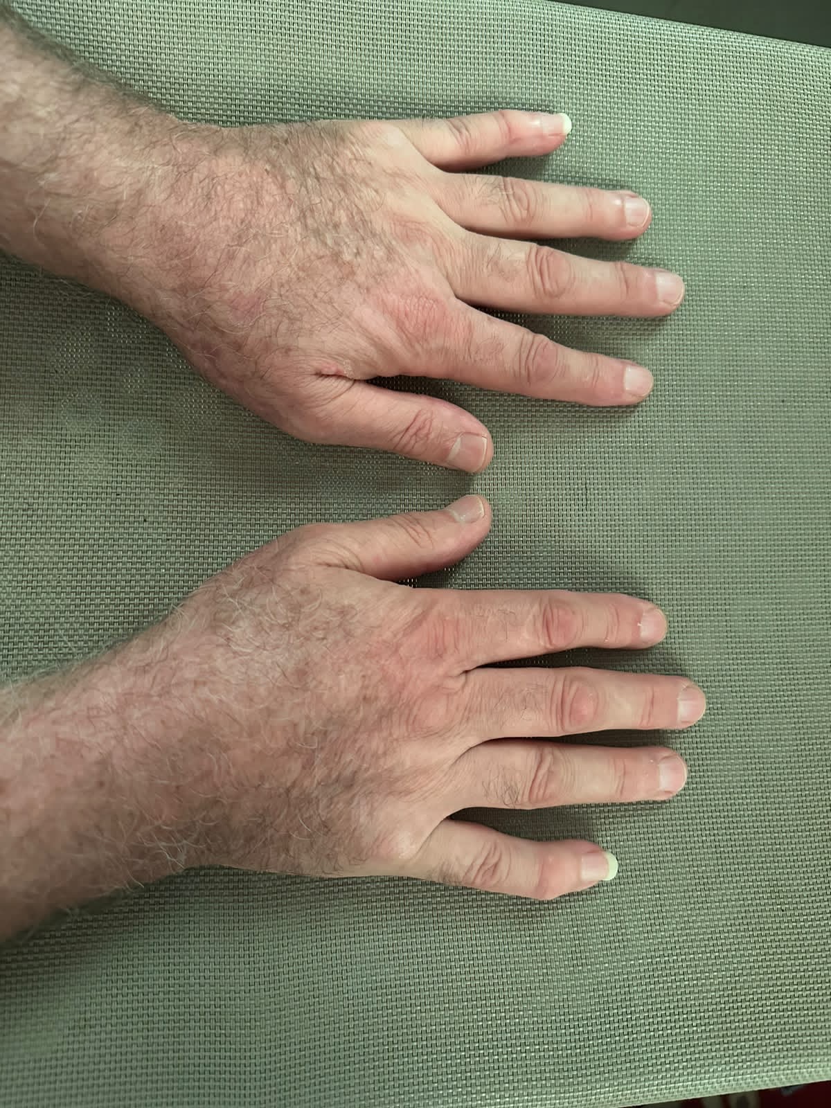 Right Hand Front